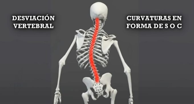 ¡Enderézate! Cuida tu columna vertebral!