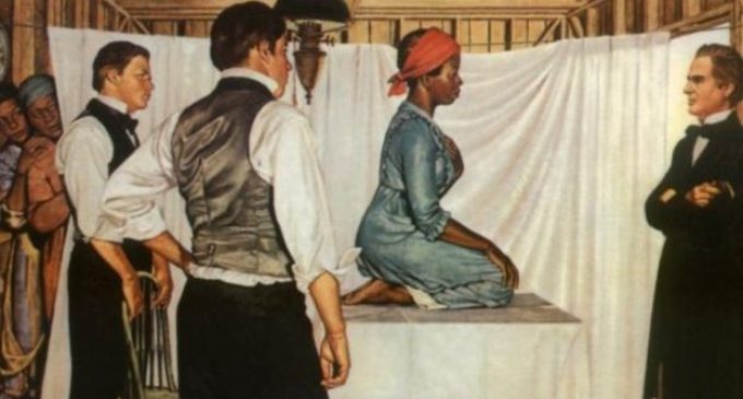 ¿Sádico o salvador?: quién fue J. Marion Sims, el médico que hizo cirugías vaginales sin anestesia en esclavas, pero es considerado el “padre de la ginecología moderna”
