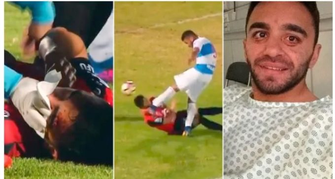 Las terribles secuelas de una escalofriante patada en el fútbol chileno