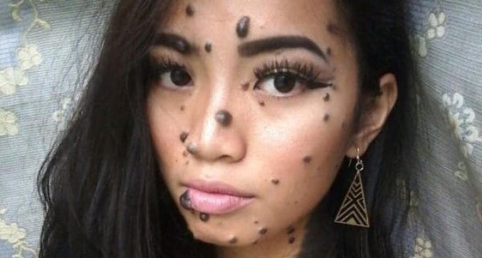 La aspirante a miss universo que deja sin palabras por sus increíbles lunares
