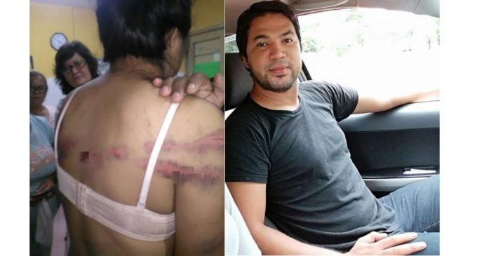 Denunciaron brutal golpiza a una mujer por parte de su concubino