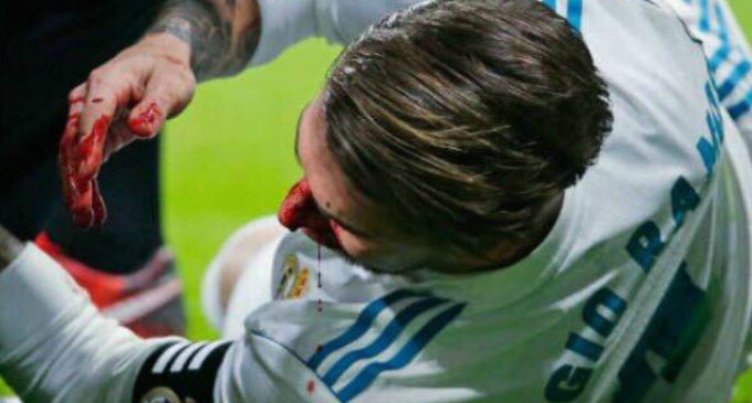 Ramos se fracturó el tabique nasal: “Volvería a sangrar una y mil veces”