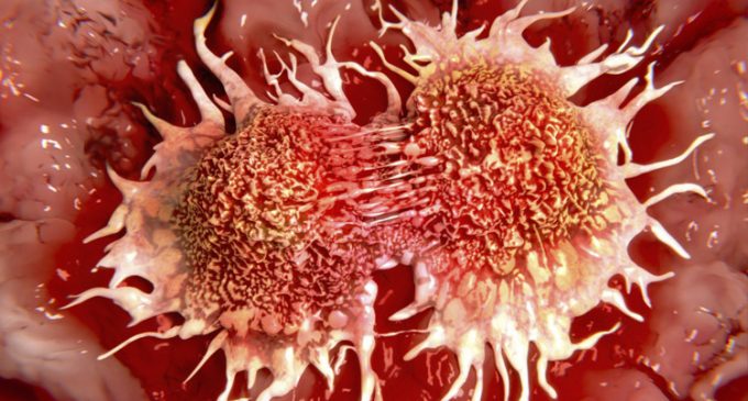 Cáncer de cabeza y cuello deja al menos 22.000 muertos al año en América Latina