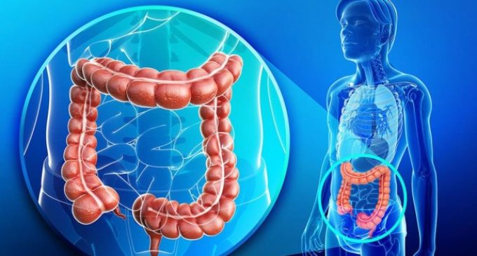 Salud insta a controles preventivos ante aumento de casos de cáncer de colon y recto