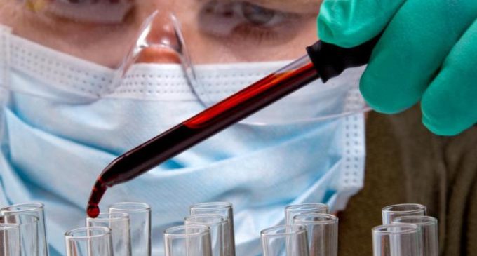 Empresas que piden prueba serológica se exponen a multas