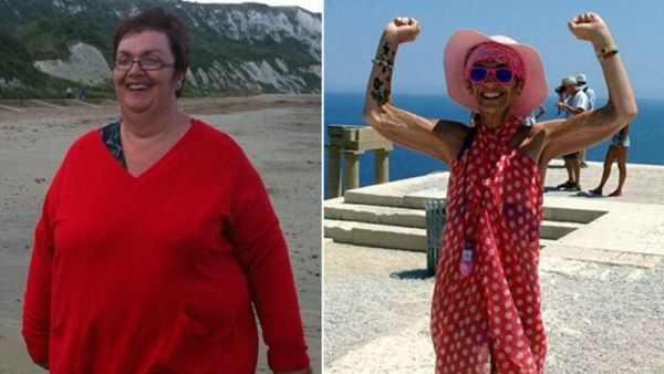 Era obesa, perdió 130 kilos y ahora sufre de anorexia
