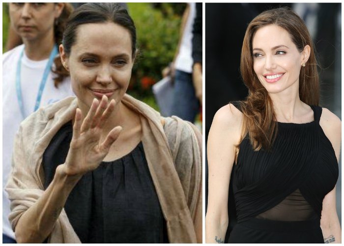 Hospitalizan a Angelina Jolie por extrema delgadez