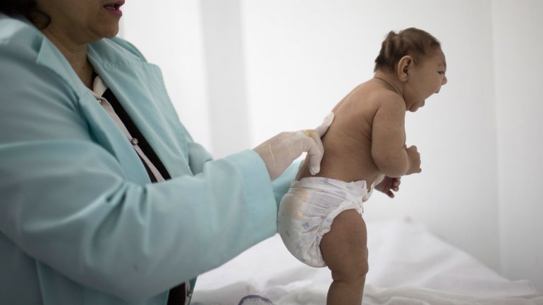 Brasil confirmó casi 1.300 casos de microcefalia vinculados al zika
