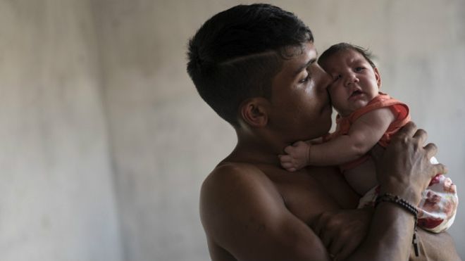 Brasil se acerca a los 1.500 casos de microcefalia relacionados con zika