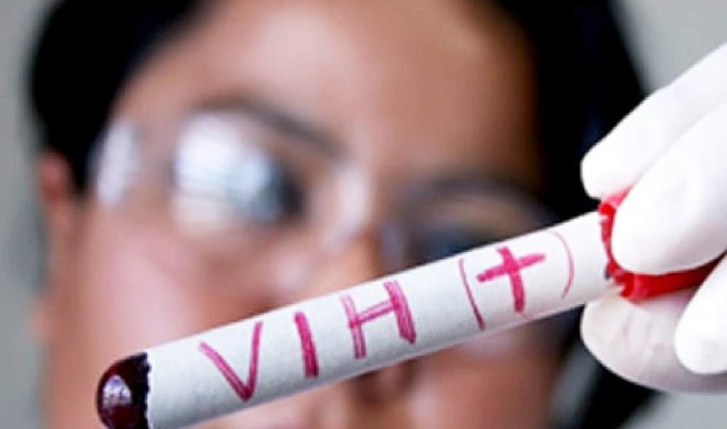 Jóvenes entre 20 a 34 años son los más afectados por el VIH