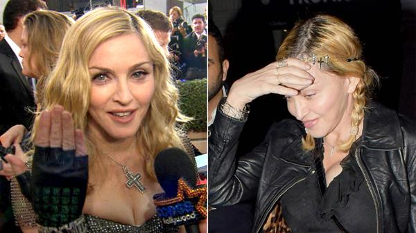 El costoso tratamiento de Madonna para quitarse las arrugas