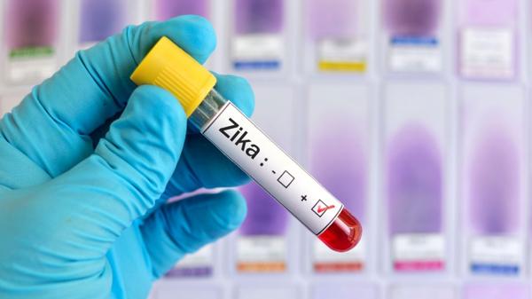 El primer centro para el estudio del virus Zika ya es una realidad