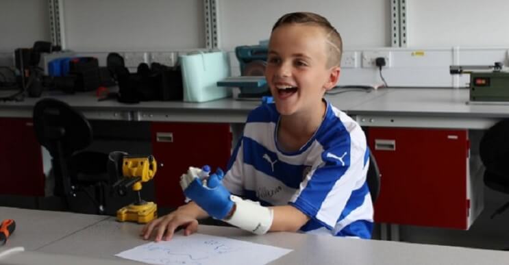 Crean una prótesis que le devuelve la alegría a un niño de 8 años
