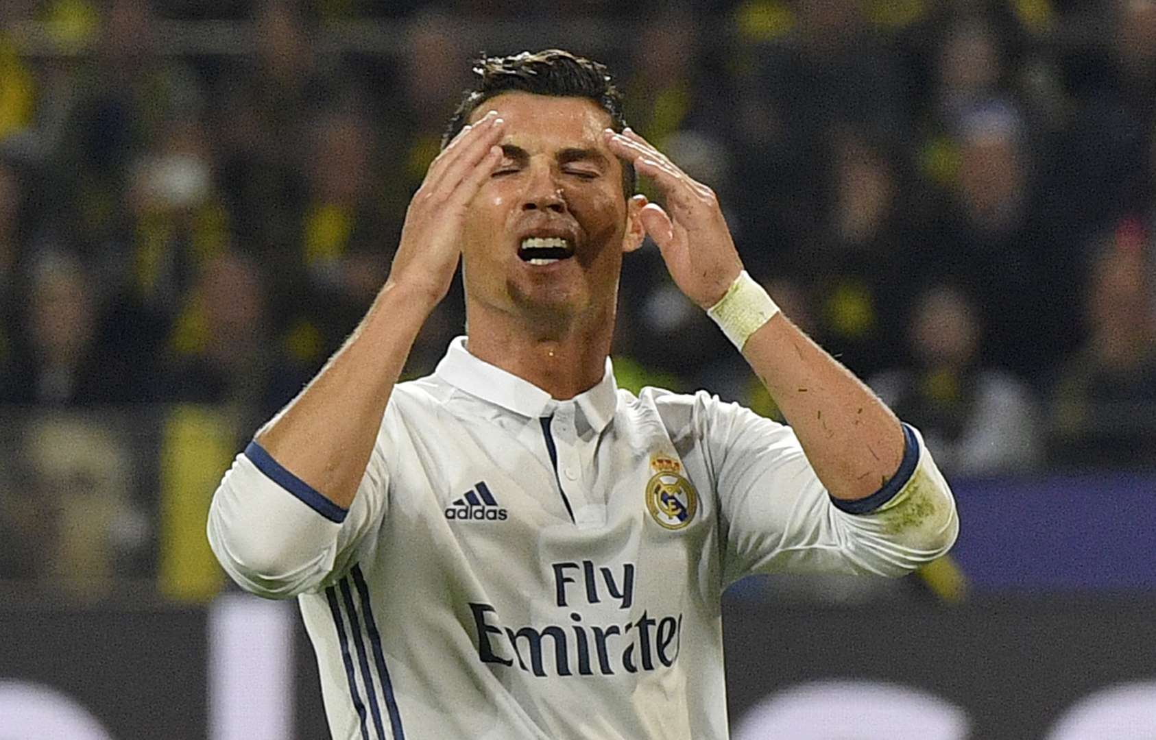 Cristiano Ronaldo, adicto al bótox