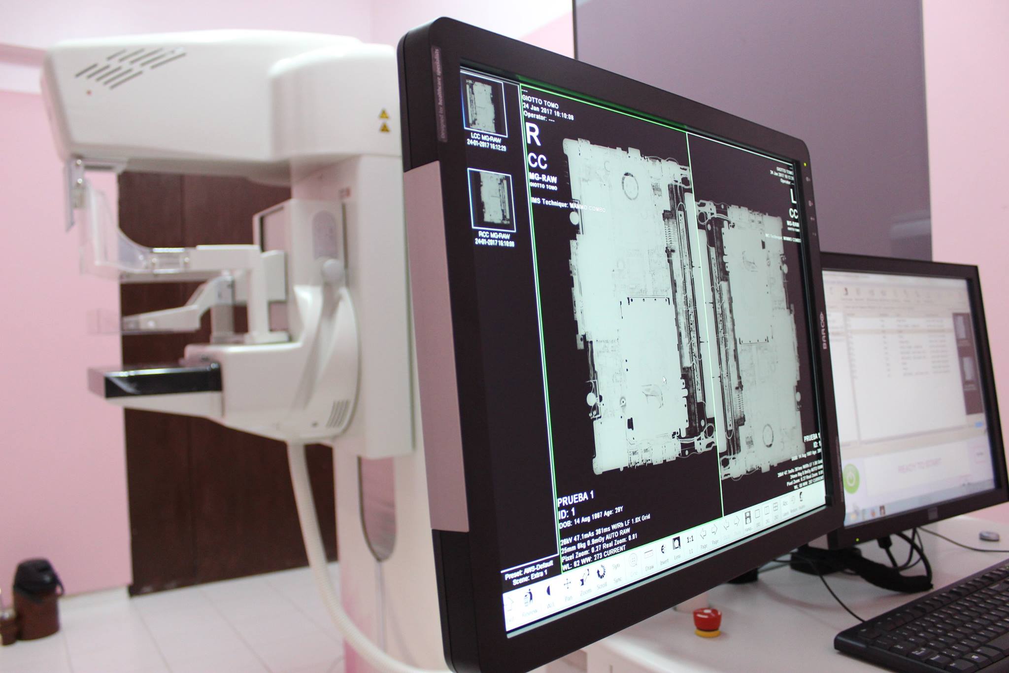 Instalan mamógrafo de última tecnología en el INCAN