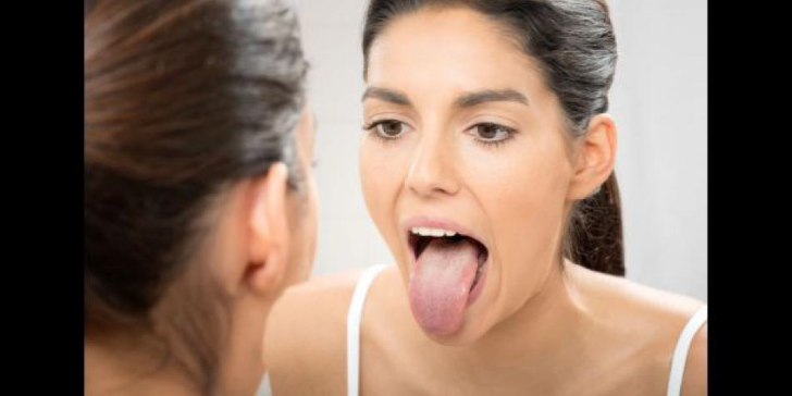 ¿Por qué la lengua se pone blanca?