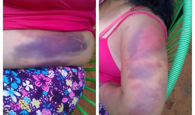 Hombre que golpeó salvajemente a su pareja se expone a 5 años de cárcel