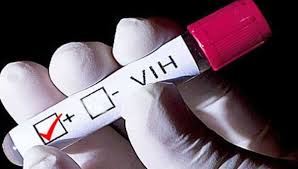 Denuncian a abogado por haber transmitido VIH a 13 mujeres