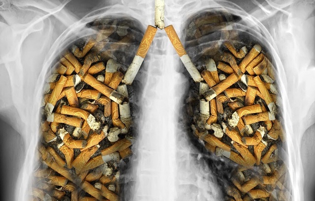 Hoy se conmemora el Día Mundial sin Tabaco