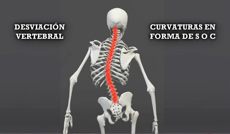 ¡Enderézate! Cuida tu columna vertebral!