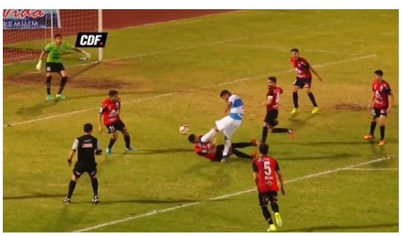 Terrible patada en el fútbol chileno: traumatismo de cráneo y diversas fracturas faciales