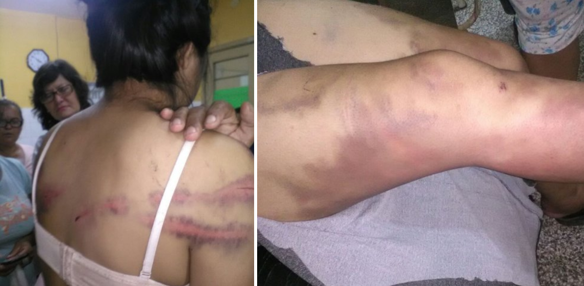 Mujer agredida quedará con cicatrices y trauma psicológico