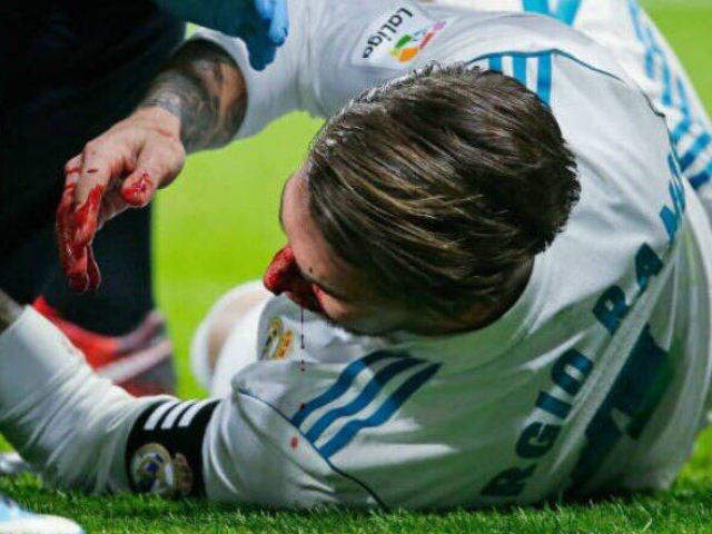 Ramos se fracturó el tabique nasal: “Volvería a sangrar una y mil veces”
