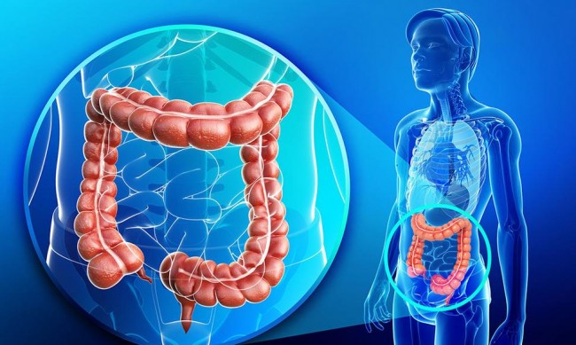 Salud insta a controles preventivos ante aumento de casos de cáncer de colon y recto