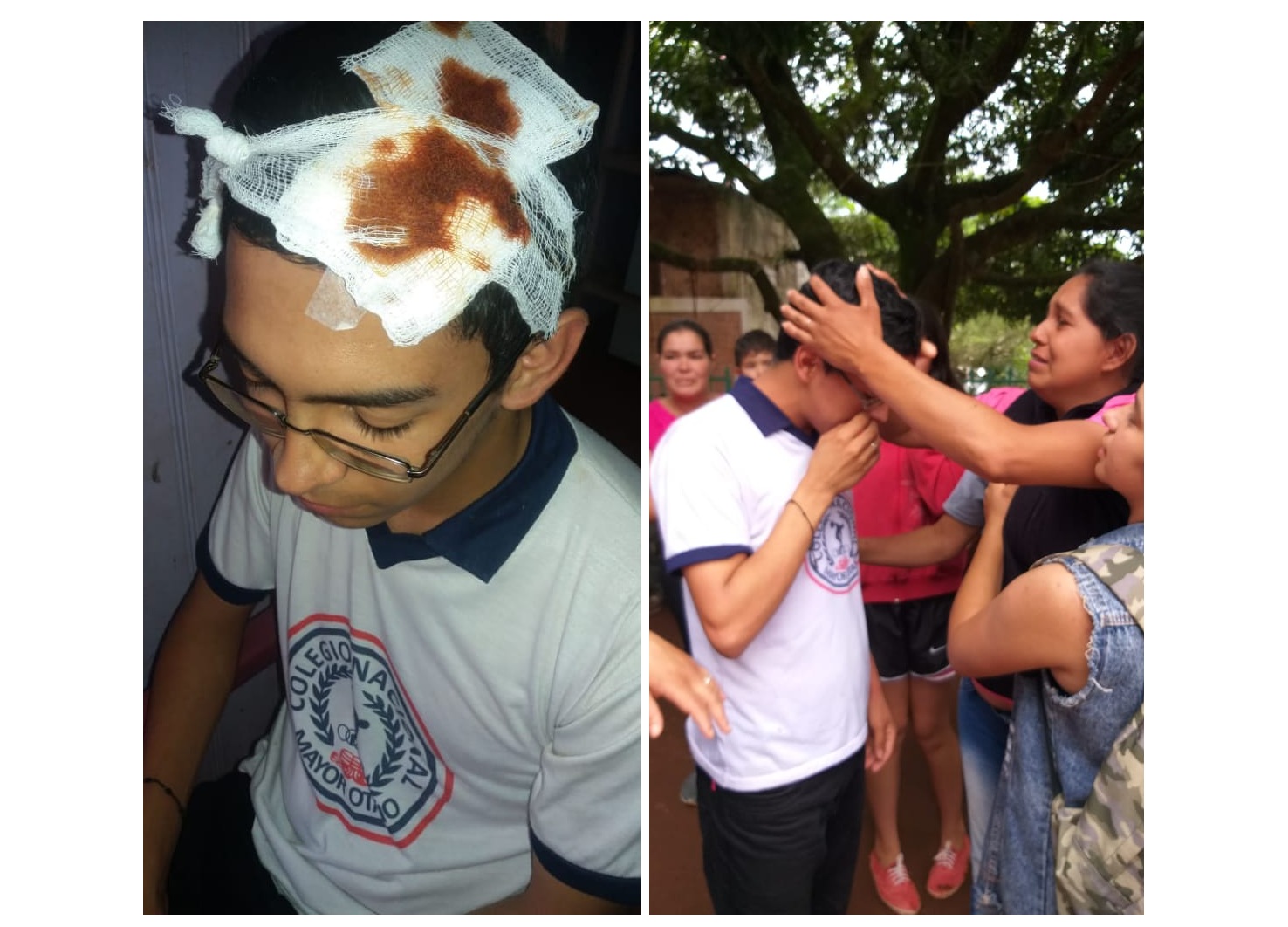 Estudiante denunció dura agresión de policía durante manifestación en Mayor Otaño