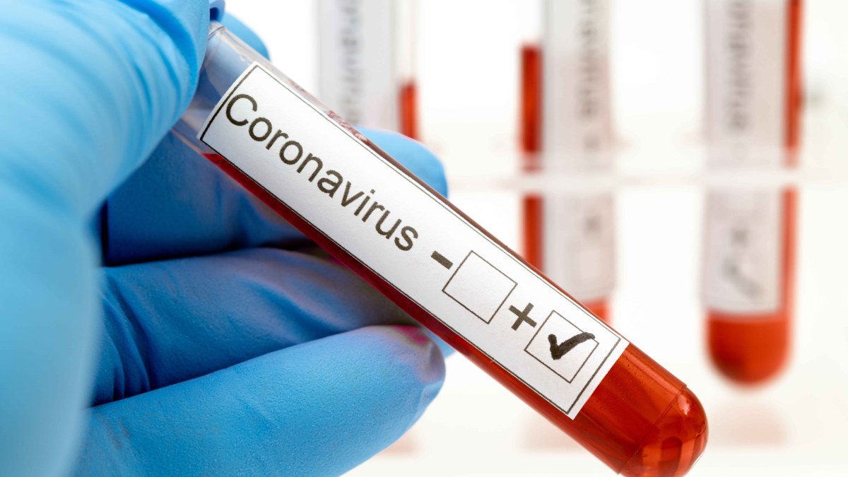 Salud confirma más de 3.000 nuevos casos positivos de COVID-19