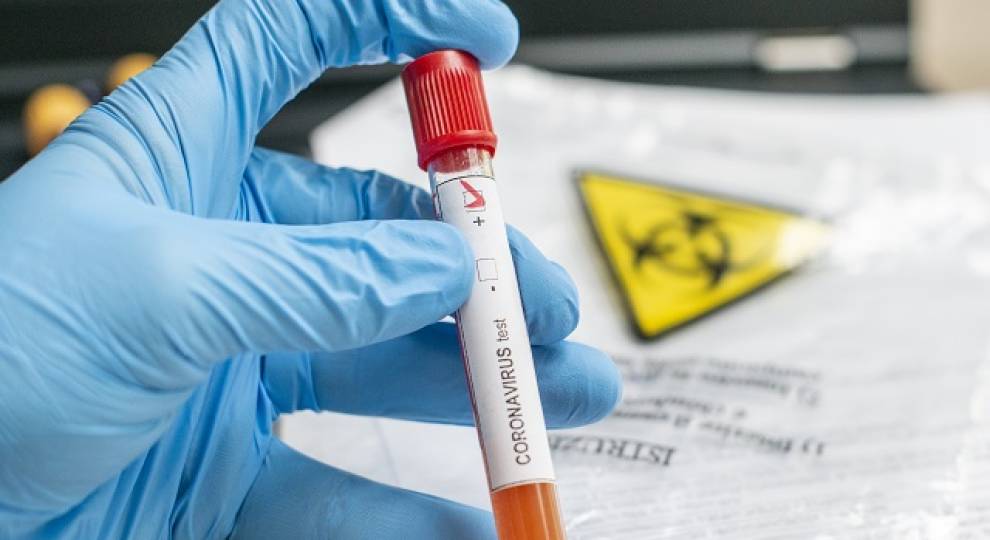 8 enfermos sin nexo resaltan de 57 nuevos positivos: Otro repunte de casos de coronavirus