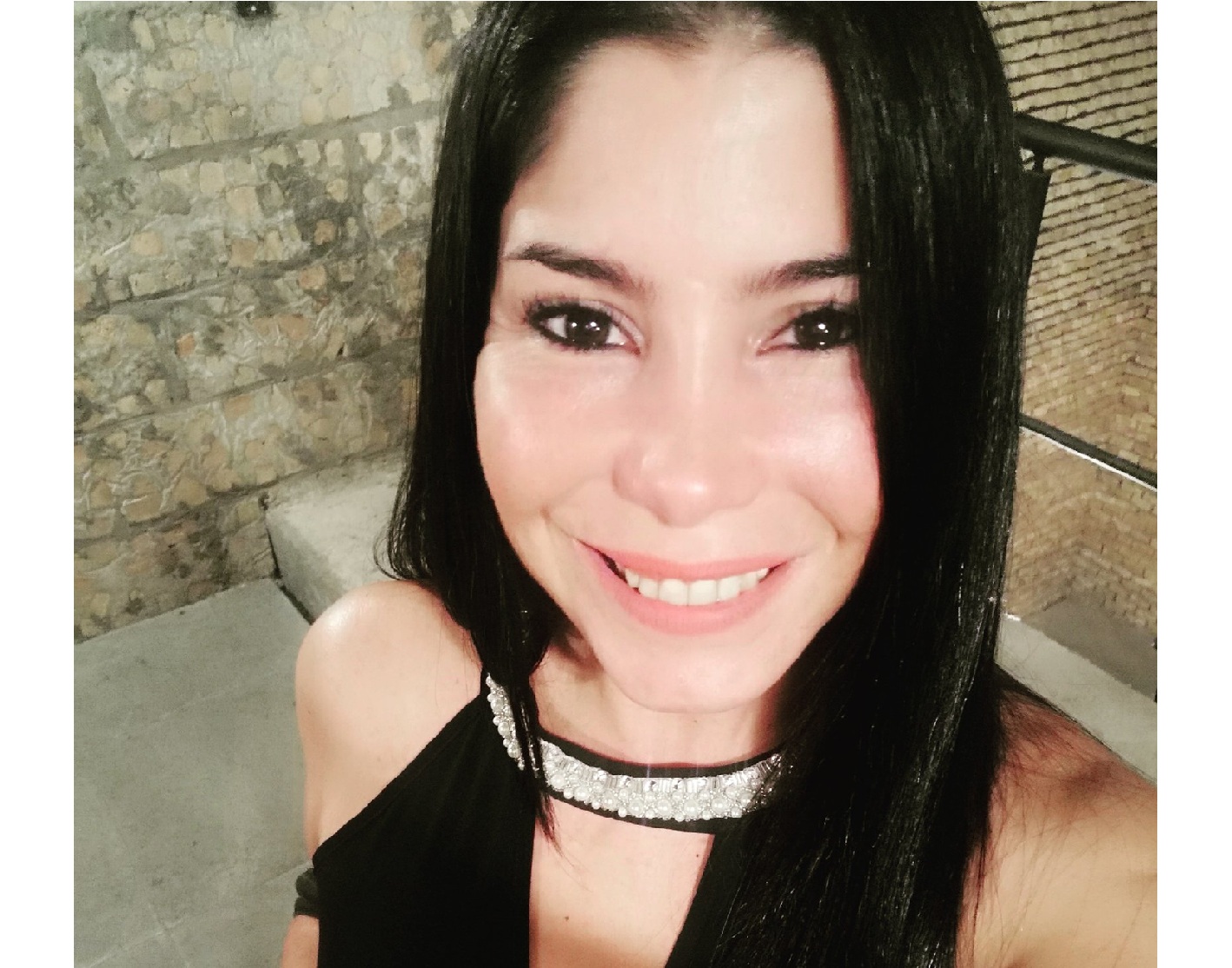 Exmodelo murió a causa de una hemorragia durante cirugía estética