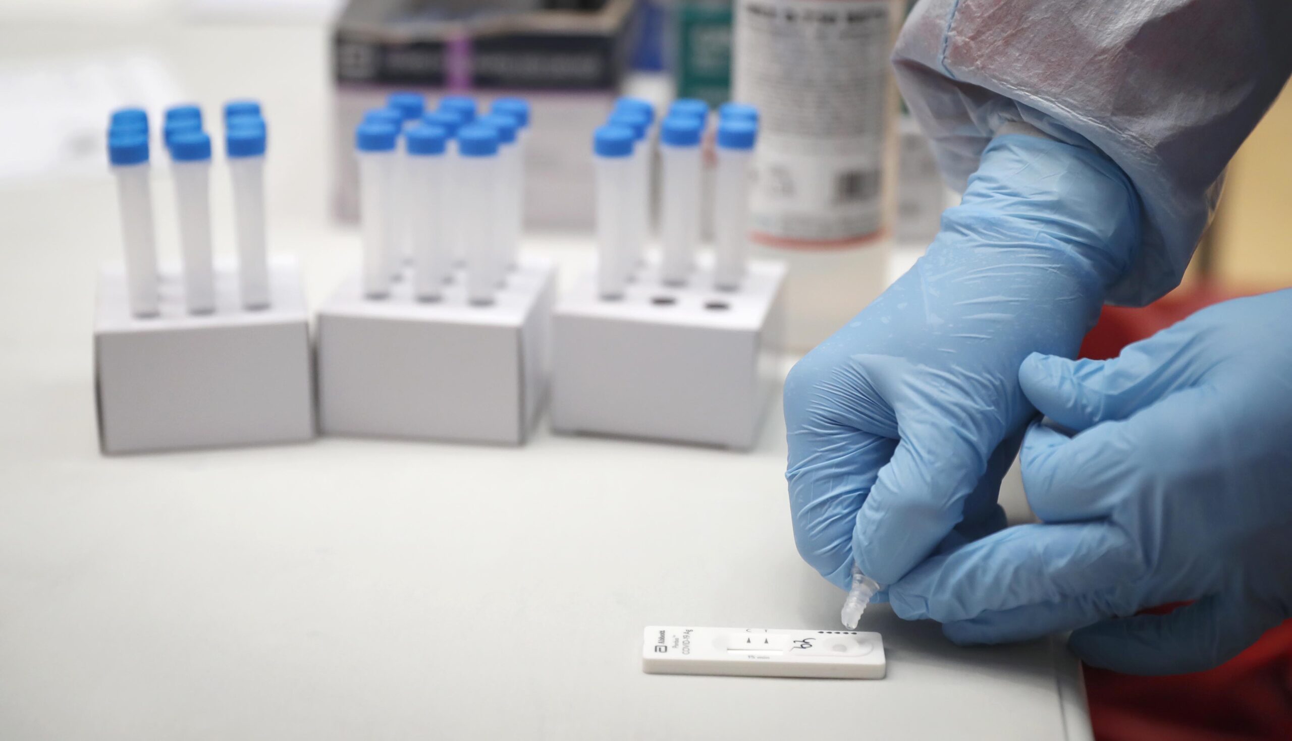 Test de antígenos se realiza ante aparición de síntomas respiratorios