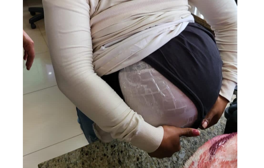 “Embarazo falso”: Cruzó a Brasil con marihuana pegada a su panza y la descubrieron