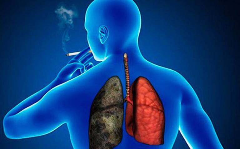 Día Mundial de la Enfermedad Pulmonar Obstructiva Crónica (EPOC)